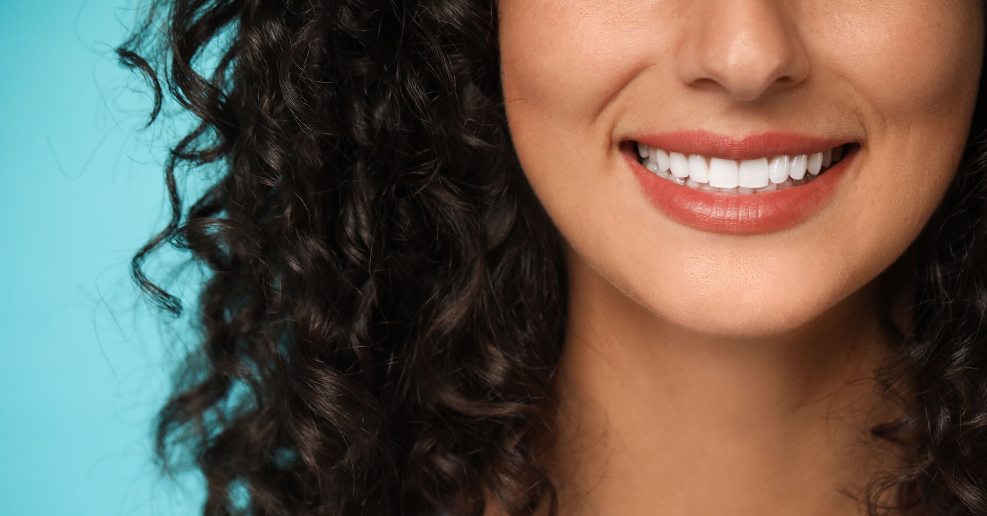 cover facette dentali