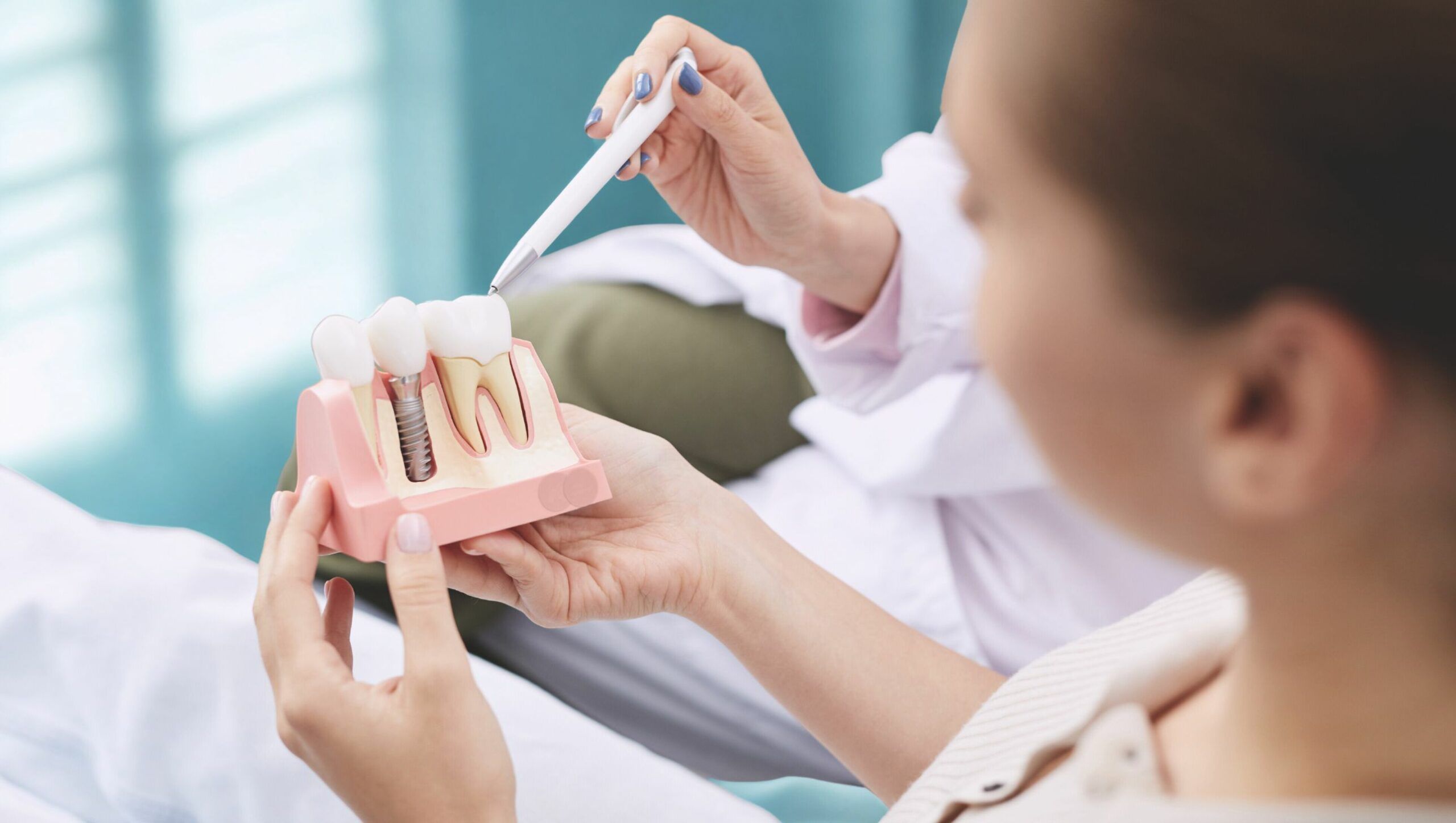 cover durata impianto